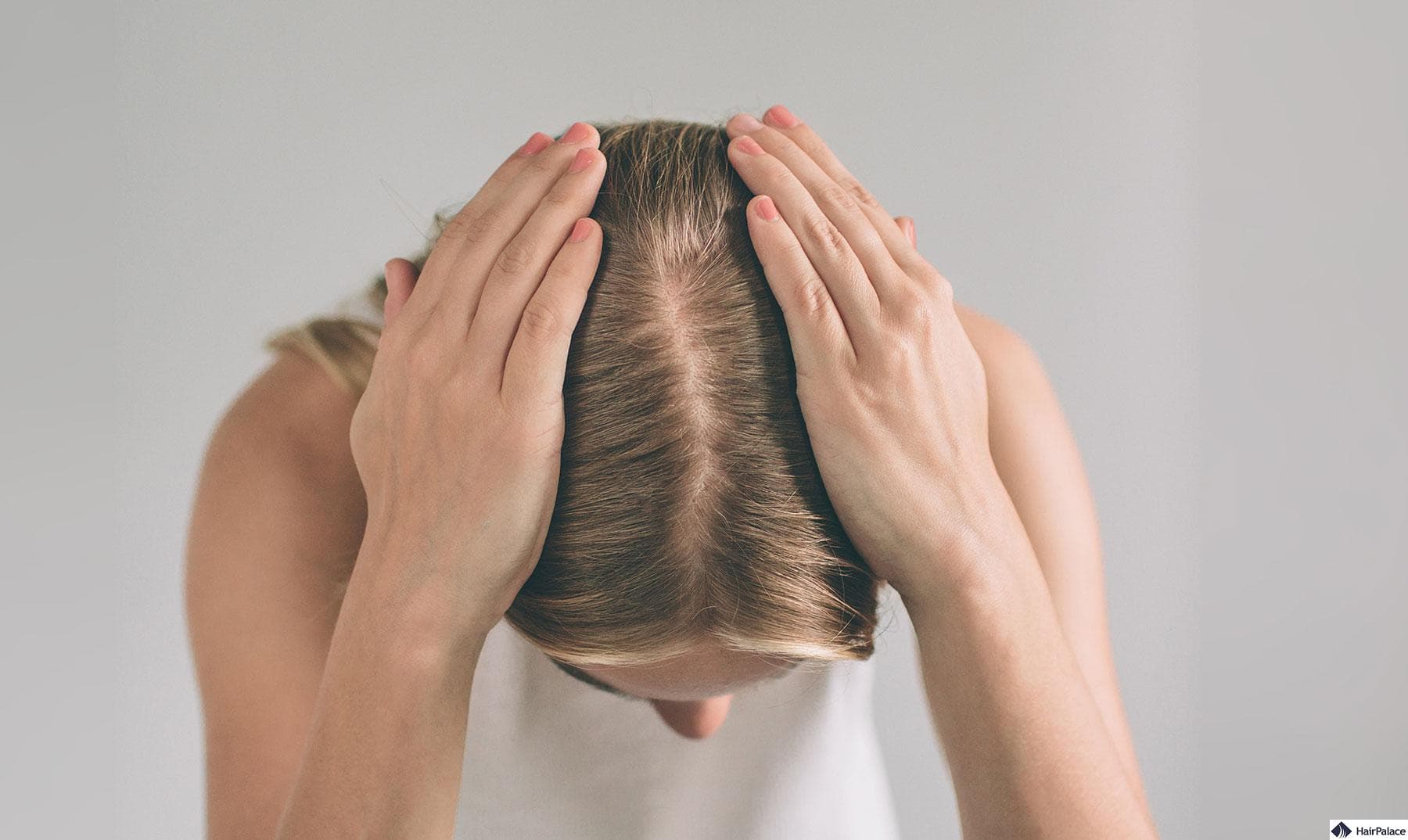 Affordable and Effective Hair Transplant UK Treatments